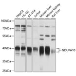 Western Blot - Anti-NDUFA10 Antibody (A12801) - Antibodies.com