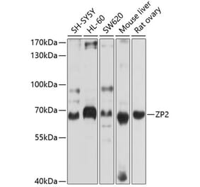 Western Blot - Anti-ZP2 Antibody (A12802) - Antibodies.com