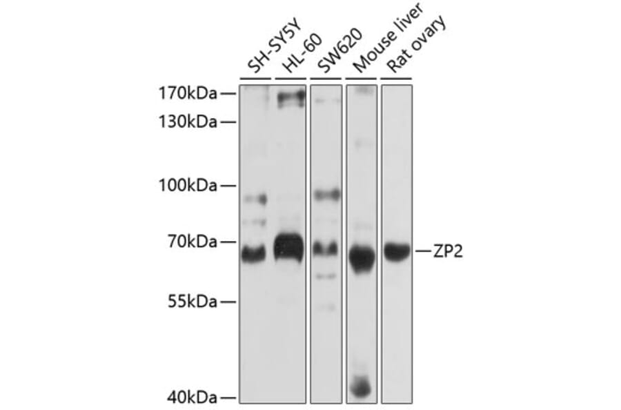 Western Blot - Anti-ZP2 Antibody (A12802) - Antibodies.com