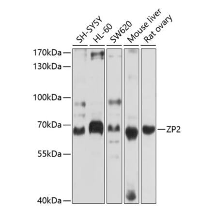 Western Blot - Anti-ZP2 Antibody (A12802) - Antibodies.com