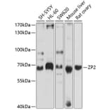 Western Blot - Anti-ZP2 Antibody (A12802) - Antibodies.com