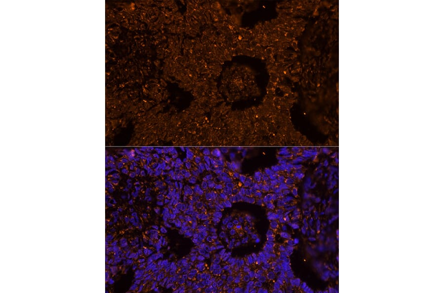 Immunofluorescence - Anti-ZP2 Antibody (A12802) - Antibodies.com