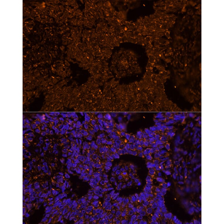 Immunofluorescence - Anti-ZP2 Antibody (A12802) - Antibodies.com