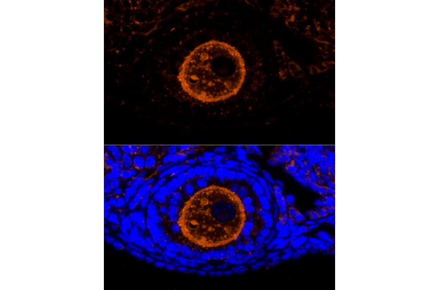 Immunofluorescence - Anti-ZP2 Antibody (A12802) - Antibodies.com