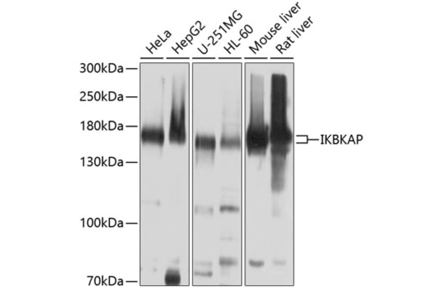 Western Blot - Anti-IKAP/p150 Antibody (A12803) - Antibodies.com
