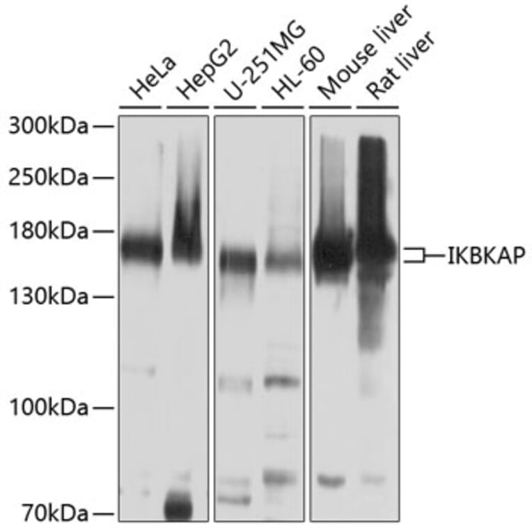 Western Blot - Anti-IKAP/p150 Antibody (A12803) - Antibodies.com
