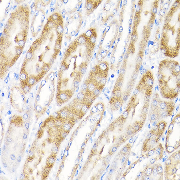 Immunohistochemistry - Anti-IKAP/p150 Antibody (A12803) - Antibodies.com