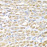 Immunohistochemistry - Anti-IKAP/p150 Antibody (A12803) - Antibodies.com