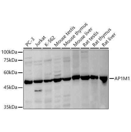 Western Blot - Anti-AP1M1 Antibody (A12804) - Antibodies.com