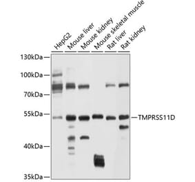 Western Blot - Anti-TMPRSS11D Antibody (A12805) - Antibodies.com