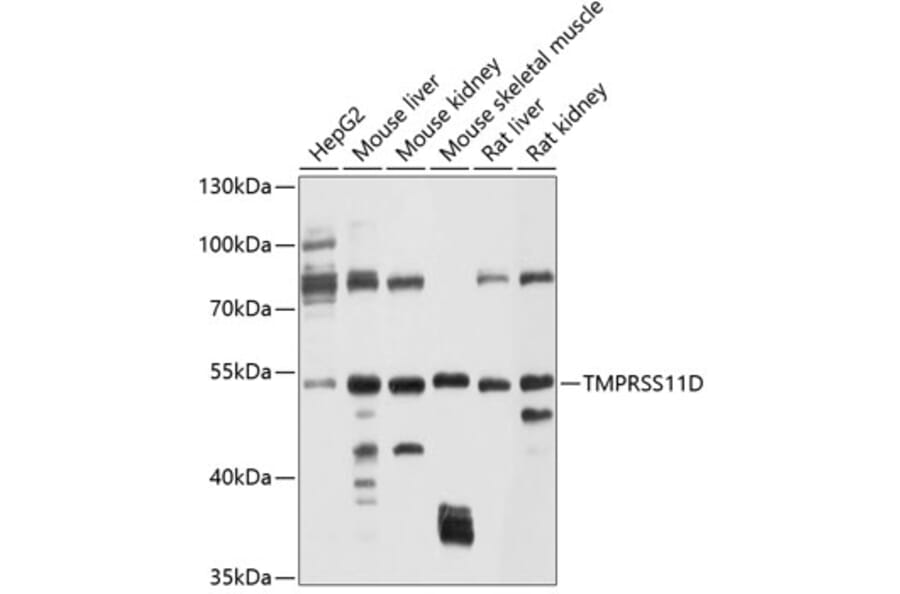 Western Blot - Anti-TMPRSS11D Antibody (A12805) - Antibodies.com