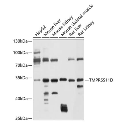 Western Blot - Anti-TMPRSS11D Antibody (A12805) - Antibodies.com