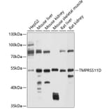 Western Blot - Anti-TMPRSS11D Antibody (A12805) - Antibodies.com