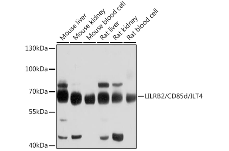 Western Blot - Anti-ILT-4 Antibody (A12806) - Antibodies.com