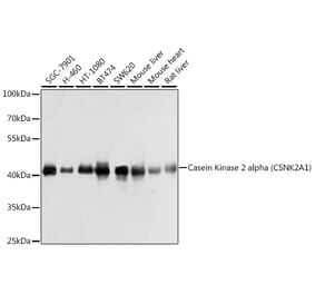 Western Blot - Anti-CSNK2A1 Antibody (A12807) - Antibodies.com