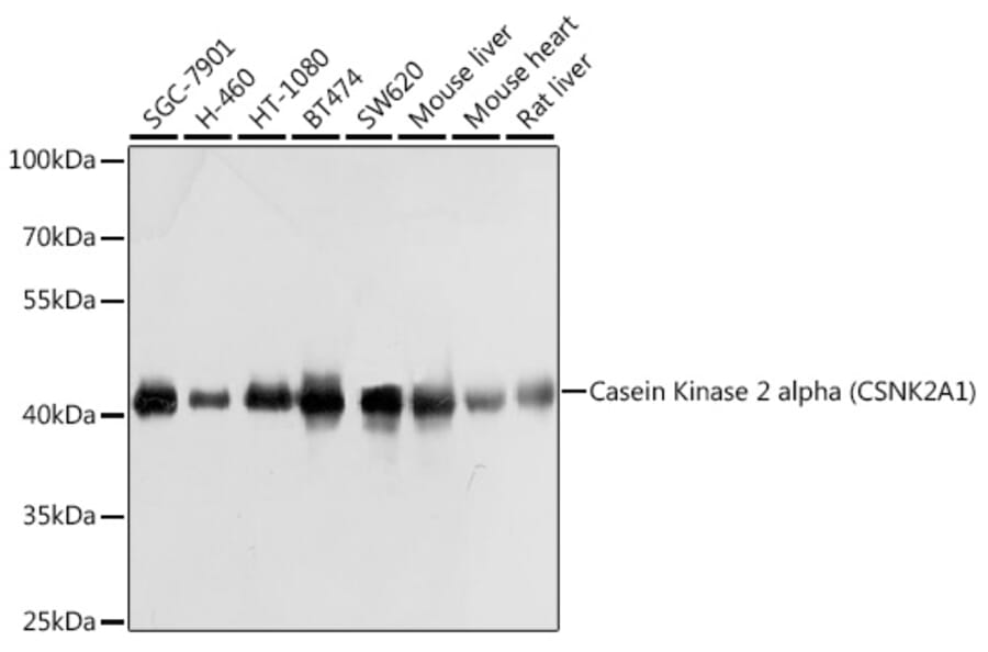 Western Blot - Anti-CSNK2A1 Antibody (A12807) - Antibodies.com