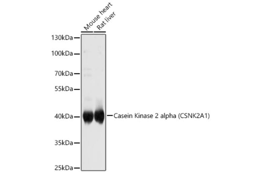 Western Blot - Anti-CSNK2A1 Antibody (A12807) - Antibodies.com