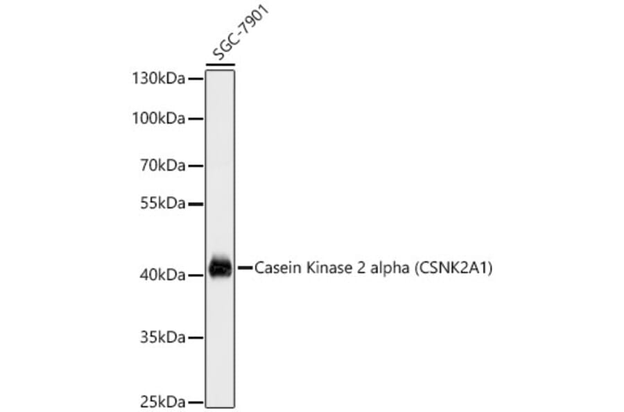 Western Blot - Anti-CSNK2A1 Antibody (A12807) - Antibodies.com