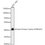 Western Blot - Anti-CSNK2A1 Antibody (A12807) - Antibodies.com