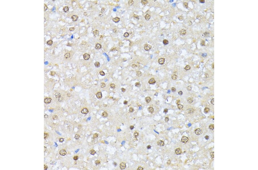 Immunohistochemistry - Anti-CSNK2A1 Antibody (A12807) - Antibodies.com