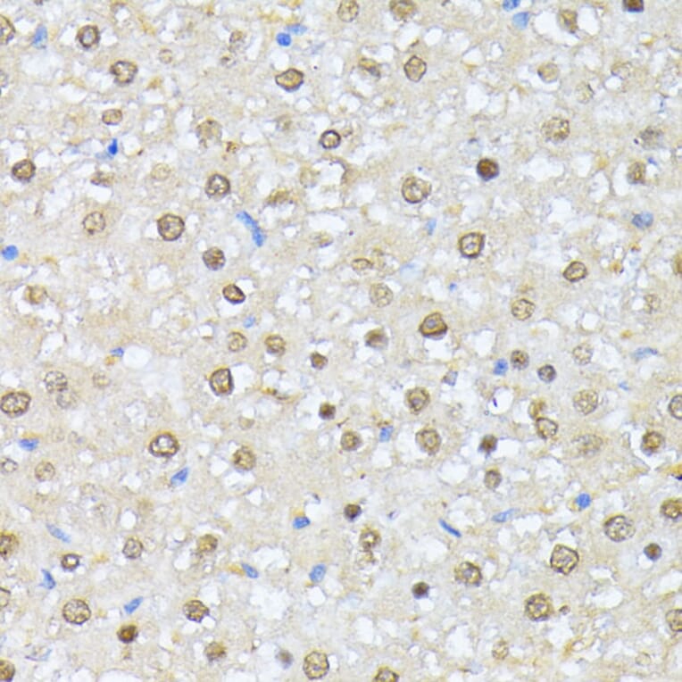 Immunohistochemistry - Anti-CSNK2A1 Antibody (A12807) - Antibodies.com