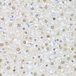 Immunohistochemistry - Anti-CSNK2A1 Antibody (A12807) - Antibodies.com