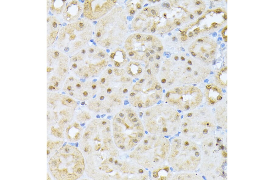 Immunohistochemistry - Anti-CSNK2A1 Antibody (A12807) - Antibodies.com