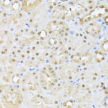 Immunohistochemistry - Anti-CSNK2A1 Antibody (A12807) - Antibodies.com
