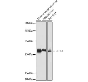 Western Blot - Anti-ETHE1 Antibody (A12808) - Antibodies.com