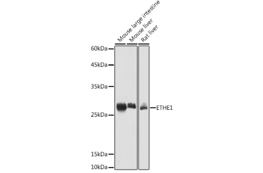 Western Blot - Anti-ETHE1 Antibody (A12808) - Antibodies.com