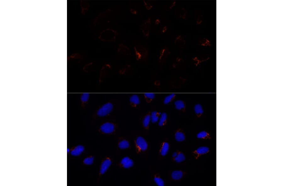 Immunofluorescence - Anti-ETHE1 Antibody (A12808) - Antibodies.com