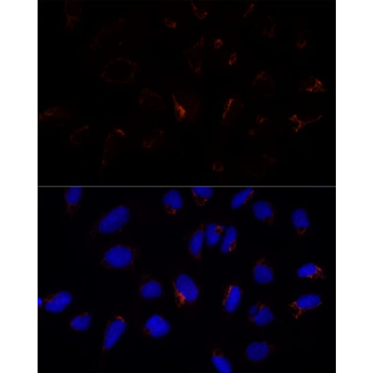 Immunofluorescence - Anti-ETHE1 Antibody (A12808) - Antibodies.com