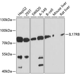 Western Blot - Anti-IL-17RB Antibody (A12809) - Antibodies.com