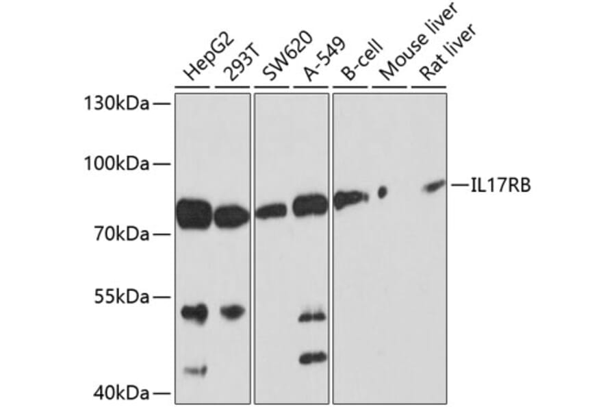 Western Blot - Anti-IL-17RB Antibody (A12809) - Antibodies.com