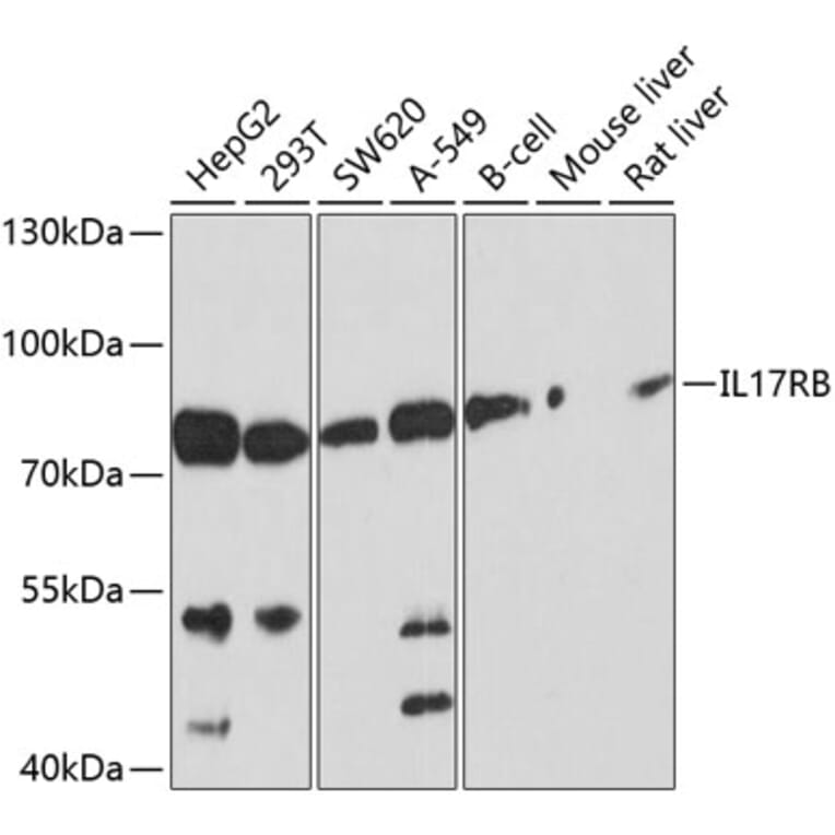 Western Blot - Anti-IL-17RB Antibody (A12809) - Antibodies.com