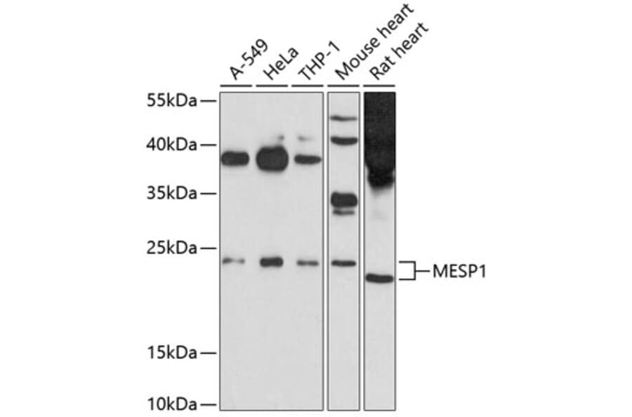 Western Blot - Anti-Mesp1 Antibody (A12810) - Antibodies.com