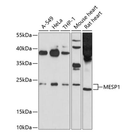 Western Blot - Anti-Mesp1 Antibody (A12810) - Antibodies.com