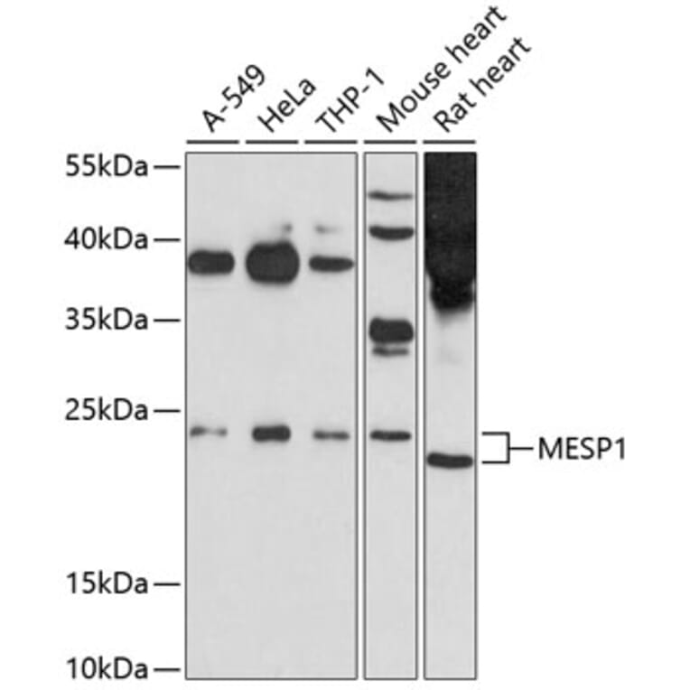 Western Blot - Anti-Mesp1 Antibody (A12810) - Antibodies.com