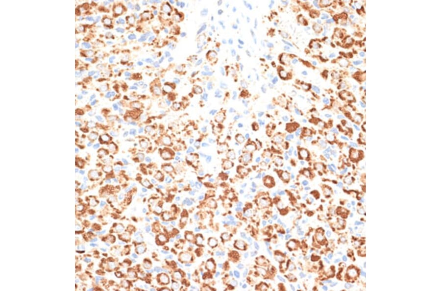 Immunohistochemistry - Anti-KLHL9 Antibody (A12811) - Antibodies.com