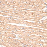 Immunohistochemistry - Anti-KLHL9 Antibody (A12811) - Antibodies.com