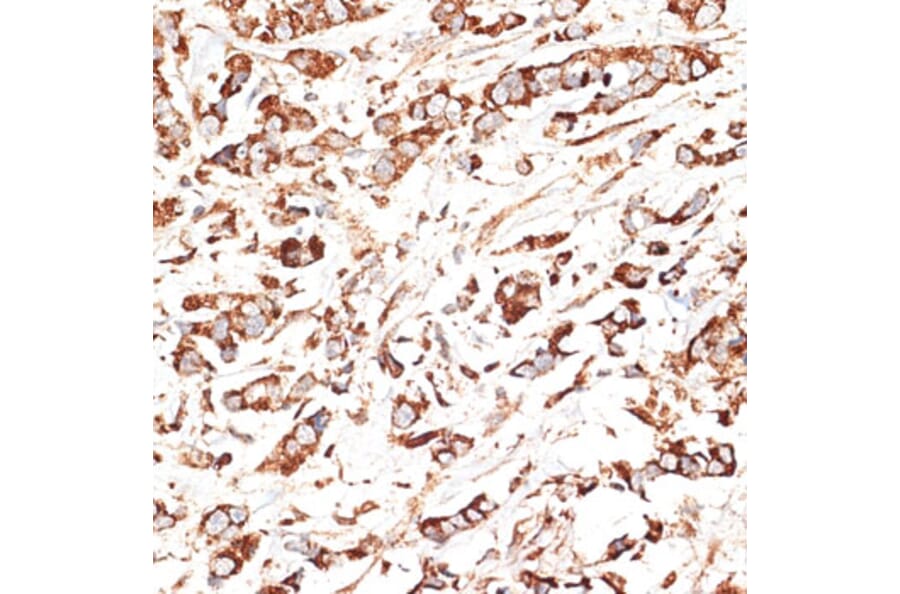 Immunohistochemistry - Anti-KLHL9 Antibody (A12811) - Antibodies.com
