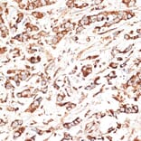 Immunohistochemistry - Anti-KLHL9 Antibody (A12811) - Antibodies.com