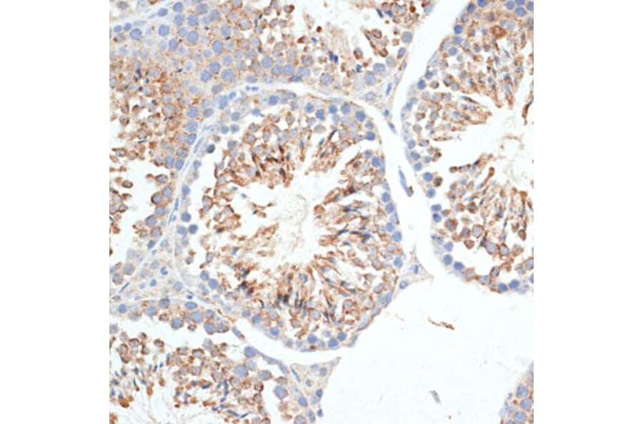 Immunohistochemistry - Anti-KLHL9 Antibody (A12811) - Antibodies.com