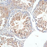 Immunohistochemistry - Anti-KLHL9 Antibody (A12811) - Antibodies.com
