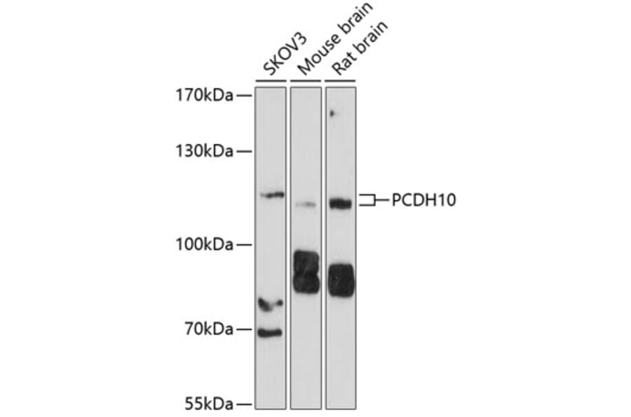 Western Blot - Anti-PCDH10 Antibody (A10150) - Antibodies.com