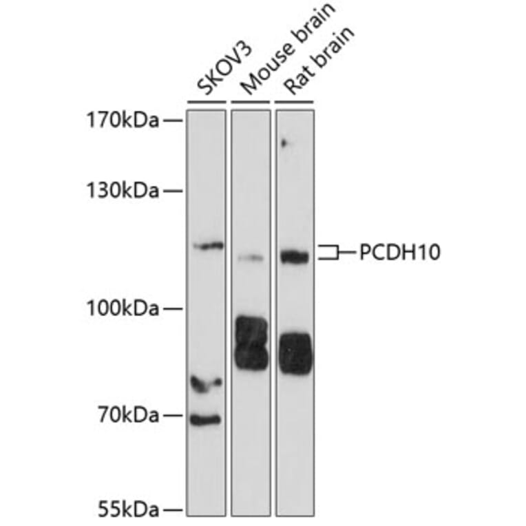 Western Blot - Anti-PCDH10 Antibody (A10150) - Antibodies.com