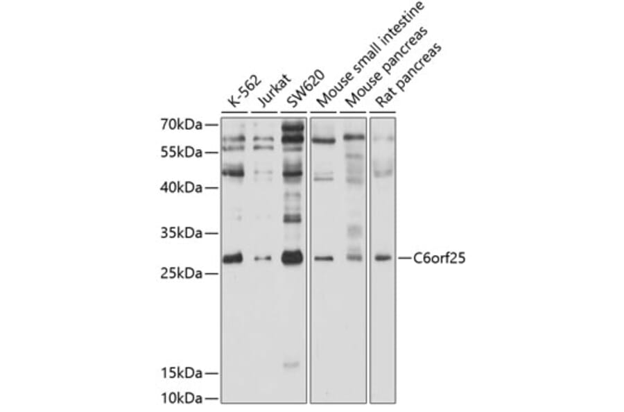 Western Blot - Anti-MPIG6B Antibody (A12813) - Antibodies.com