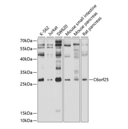 Western Blot - Anti-MPIG6B Antibody (A12813) - Antibodies.com