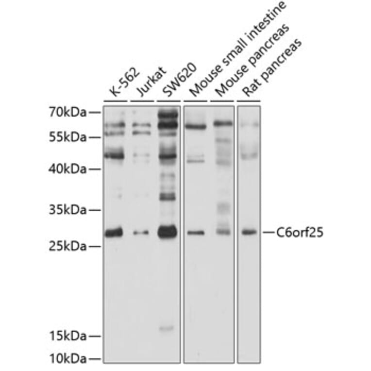 Western Blot - Anti-MPIG6B Antibody (A12813) - Antibodies.com