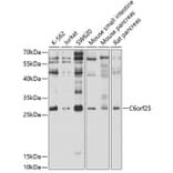 Western Blot - Anti-MPIG6B Antibody (A12813) - Antibodies.com